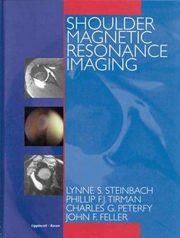 Shoulder magnetic resonance imaging