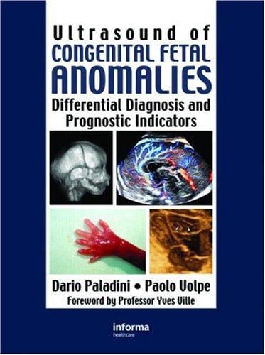 Ultrasound of congenital fetal anomalies