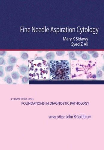 Fine Needle Aspiration Cytology