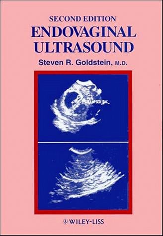 Endovaginal ultrasound
