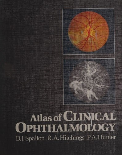 Atlas of clinical ophthalmology