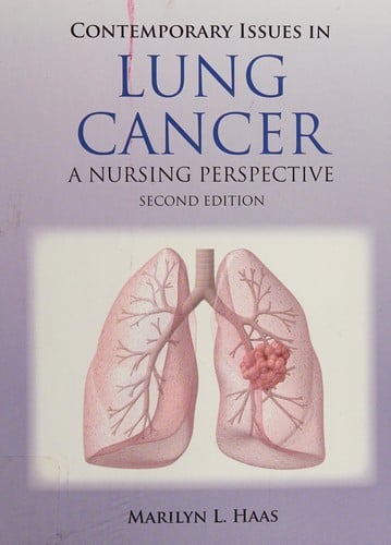 Contemporary issues in lung cancer