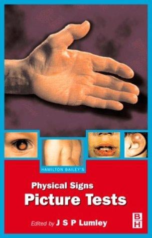 Hamilton Bailey's demonstrations of physical signs