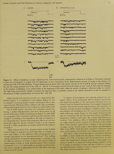 Cardiac electrophysiology and arrhythmias