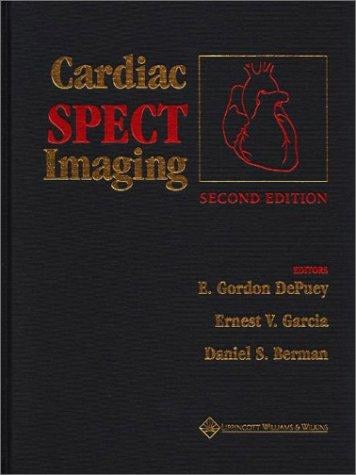 Cardiac spect imaging