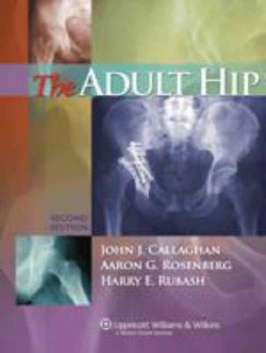 The adult hip