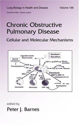Chronic obstructive pulmonary disease