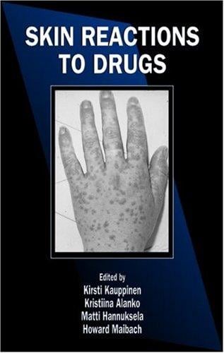 Skin reactions to drugs