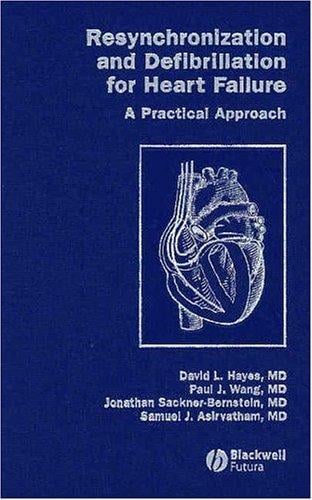 Resynchronization and defibrillation for heart failure