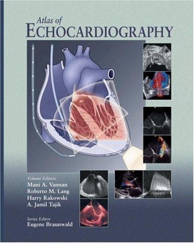 Atlas of echocardiography