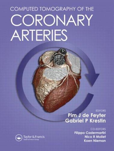 COMPUTED TOMOGRAPHY OF THE CORONARY ARTERIES