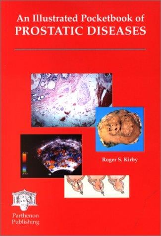 An illustrated pocketbook of prostatic diseases