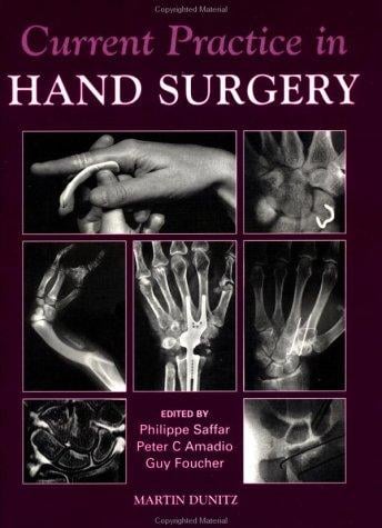 Current practice in hand surgery