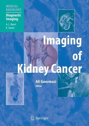 Imaging of kidney cancer