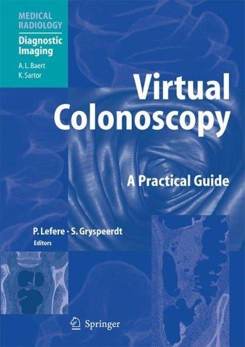 Virtual colonoscopy
