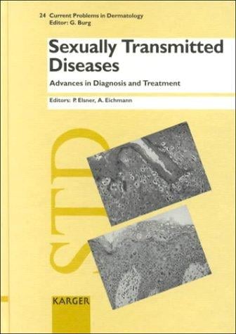 Sexually transmitted diseases