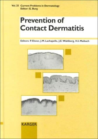 Prevention of contact dermatitis