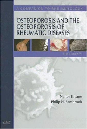 Osteoporosis and the osteoporosis of rheumatic diseaes