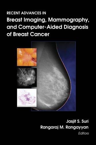 Recent advances in breast imaging, mammography, and computer-aided diagnosis of breast cancer