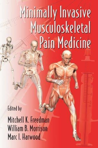 Minimally invasive musculoskeletal pain medicine