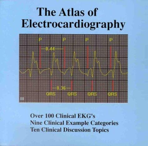 The Atlas of Electrocardiography for Windows, Student Version
