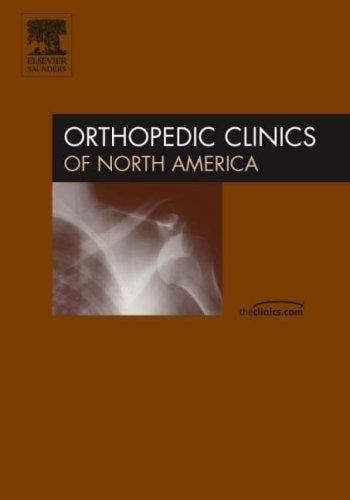 Women's Musculoskeletal Health Issues, An Issue of Orthopedic Clinics (The Clinics: Orthopedics)
