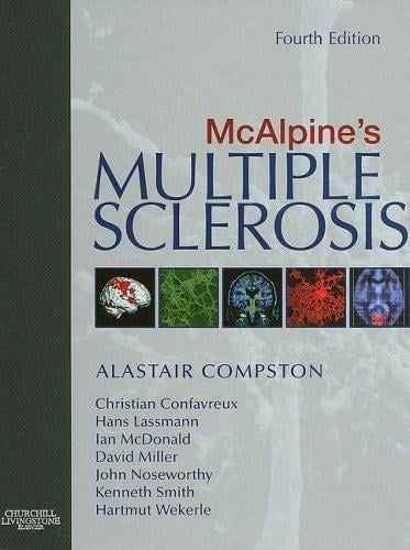 McAlpine's multiple sclerosis