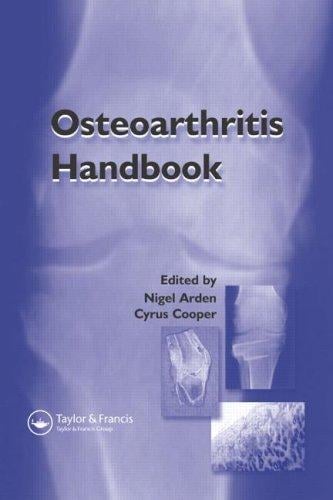 OSTEOARTHRITIS HANDBOOK; ED. BY NIGEL ARDEN