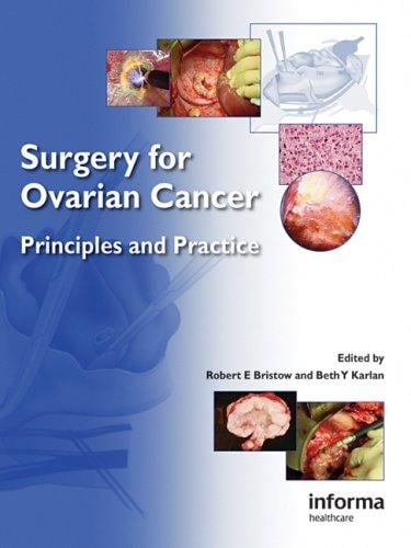 Surgery for ovarian cancer