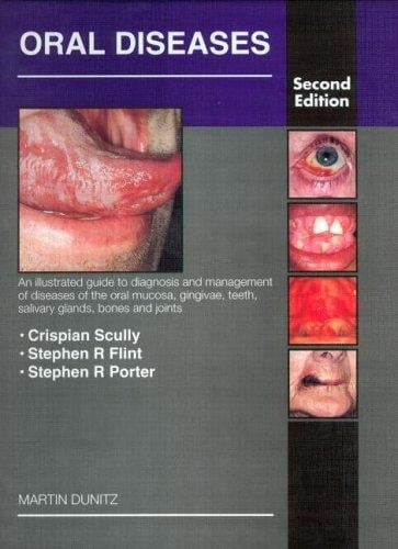 Oral diseases