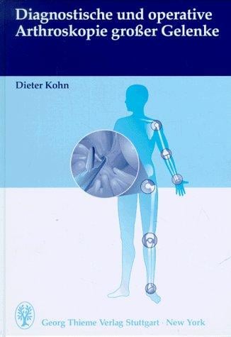 Diagnostische und operative Arthroskopie großer Gelenke