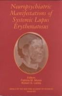 Neuropsychiatric manifestations of systemic lupus erythematosus