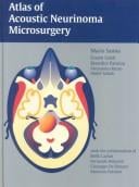 Atlas of acoustic neurinoma microsurgery
