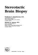 Stereotactic brain biopsy