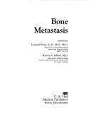 Bone metastasis