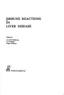 Immune reactions in liver disease