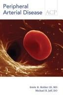 Peripheral arterial disease