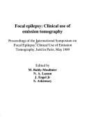 Focal epilepsy