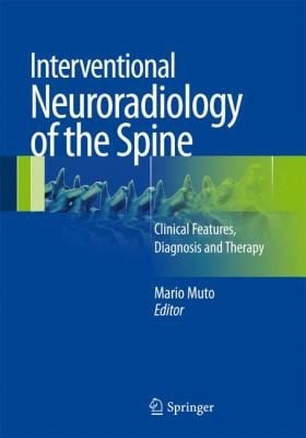 Interventional Neuroradiology Of The Spine Clinical Features Diagnosis And Therapy