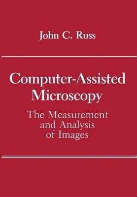 Computerassisted Microscopy The Measurement And Analysis Of Images