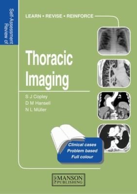 SelfAssessment Colour Review of Thoracic Imaging
