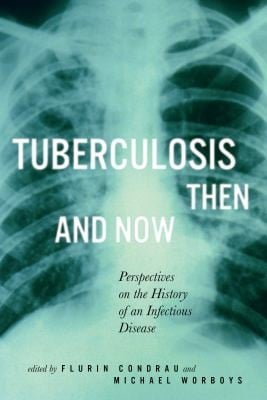 Tuberculosis Then And Now Perspectives On The Hisotry Of An Infectious Disease