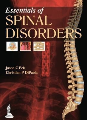 Essentials Of Spinal Disorders