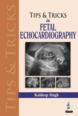 Tips  Tricks in Fetal Echocardiography