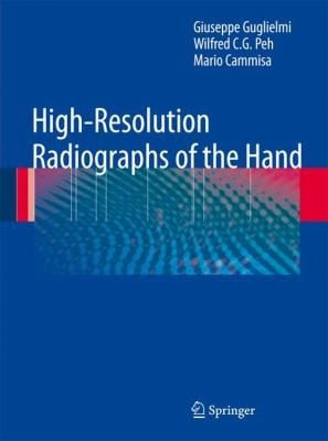 Highresolution Radiographs Of The Hand