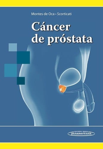 Cáncer de próstata