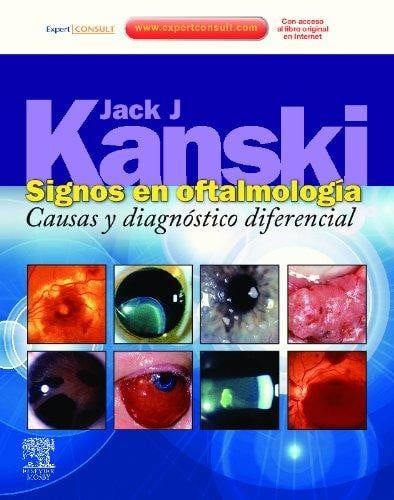 Signos en oftalmología : causas y diagnóstico diferencial