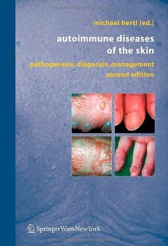 Autoimmune Diseases of the Skin: Pathogenesis, Diagnosis, Management