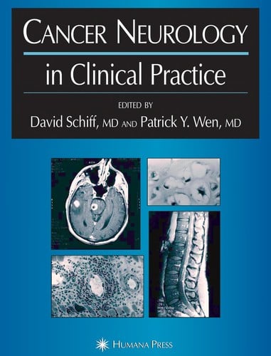 Cancer neurology in clinical practice