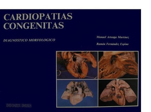 Cardiopatías congénitas